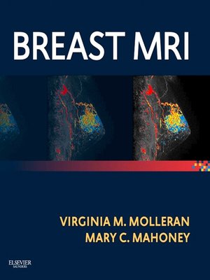 cover image of Breast MRI E-Book
